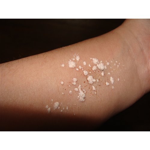 powder on moistened body