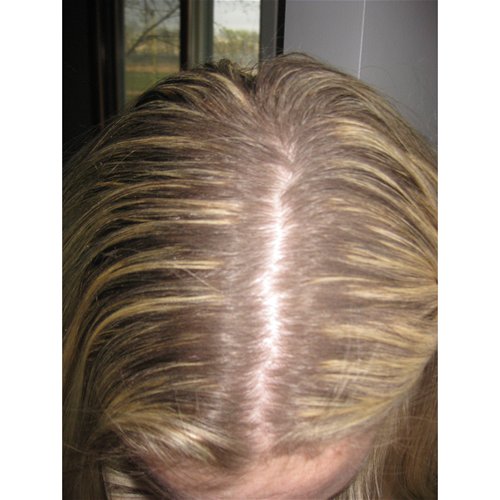 Powder applied to roots alone