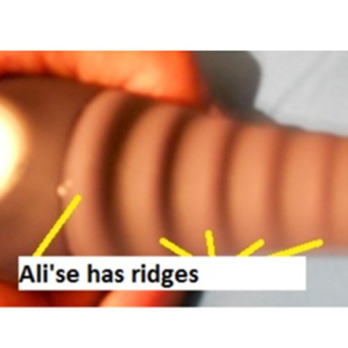 ridges